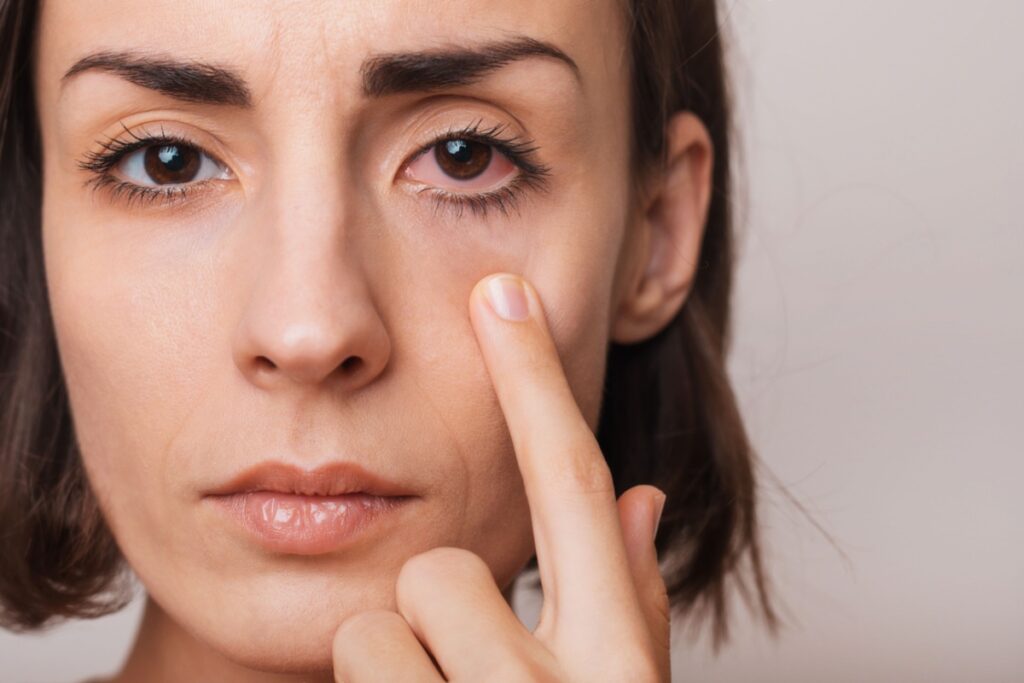 Woman pointing to lower eyelid area checking for irritation or foreign object causing eye discomfort.